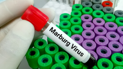 Ethiopia Declares End to Marburg Outbreak After Nine Deaths