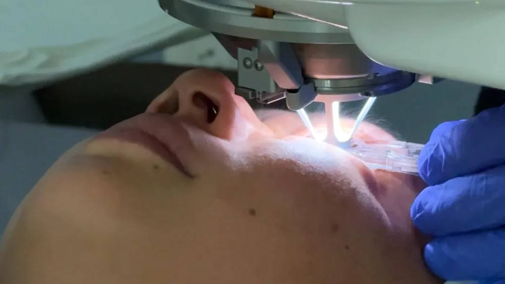 KI revolutioniert LASIK für verbesserte Sehkraft