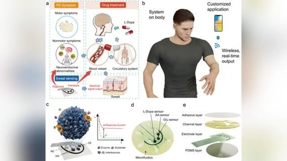 Científicos chinos crean sistema portátil de detección de sudor para Parkinson