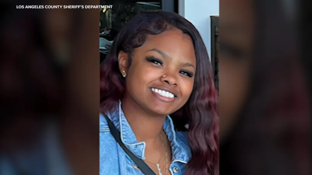 $10,000 reward offered after 21-year-old nursing student was shot in head while driving in Westmont area