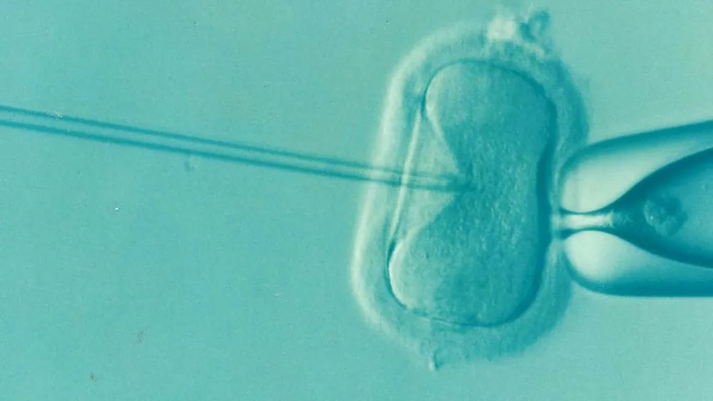 Three-Person IVF Technique Prevents Inherited Diseases in Children