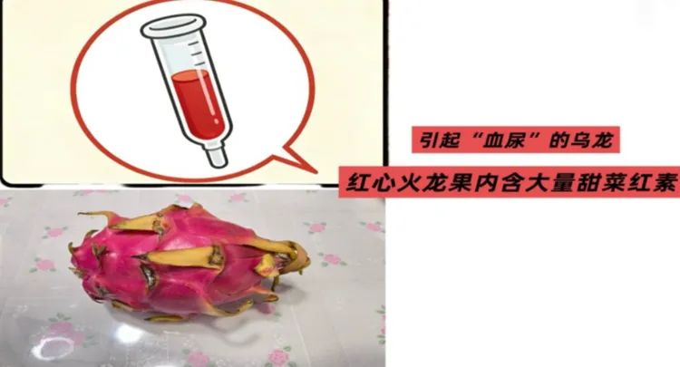 Dragon fruit benefits overshadowed by blood in urine in children