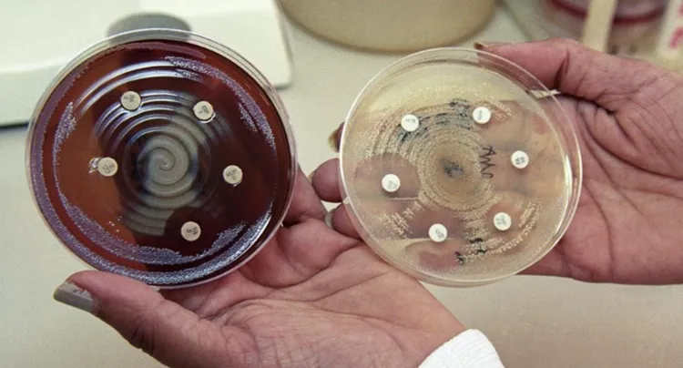 mupirocina para infecciones de la piel evita el uso indebido