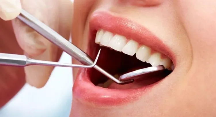 los espacios dentales aumentan tras limpieza dental ¿por qué es un mito?