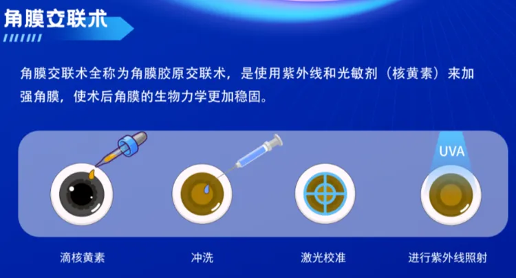 Myopia surgeries needing corneal cross-linking reinforcement explained