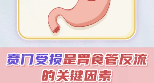 How to use medication for GERD when stomach acid worsens symptoms